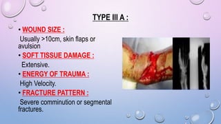 TYPE III A :
• WOUND SIZE :
Usually >10cm, skin flaps or
avulsion
• SOFT TISSUE DAMAGE :
Extensive.
• ENERGY OF TRAUMA :
High Velocity.
• FRACTURE PATTERN :
Severe comminution or segmental
fractures.
 
