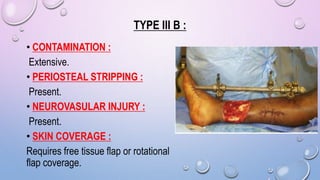 TYPE III B :
• CONTAMINATION :
Extensive.
• PERIOSTEAL STRIPPING :
Present.
• NEUROVASULAR INJURY :
Present.
• SKIN COVERAGE :
Requires free tissue flap or rotational
flap coverage.
 