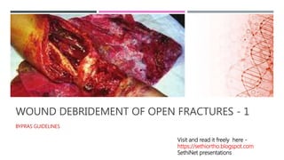 WOUND DEBRIDEMENT OF OPEN FRACTURES - 1
BYPRAS GUIDELINES
Visit and read it freely here -
https://sethiortho.blogspot.com
SethiNet presentations
 