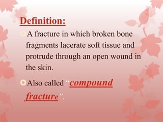 Definition:
A fracture in which broken bone
fragments lacerate soft tissue and
protrude through an open wound in
the skin.
Also called “compound
fracture”.
 