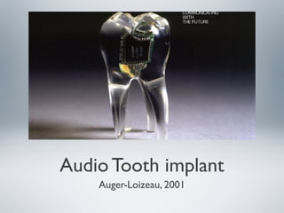 Audio Tooth implant
Auger-Loizeau, 2001
 