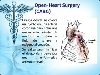 Cirugía donde se coloca un injerto en una arteria coronaria para crear una nueva ruta arterial de modo que mejore el flujo de sangre y oxigeno al corazón. Se realiza para minimizar el riesgo de muerte por una enfermedad arterocoronaria.  