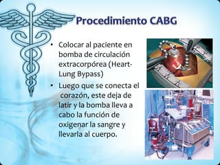 Colocar al paciente en bomba de circulación extracorpórea (Heart-Lung Bypass) Luego que se conecta el  corazón, este deja de latir y la bomba lleva a cabo la función de oxigenar la sangre y llevarla al cuerpo. 