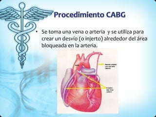 Se toma una vena o arteria  y se utiliza para crear un desvío (o injerto) alrededor del área bloqueada en la arteria. 