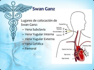 Lugares de colocación de Swan Ganz: Vena Subclavia Vena Yugular Interna Vena Yugular Externa Vena Cefálica Femoral 