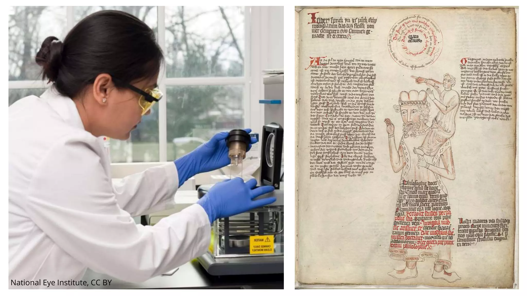 National Eye Institute, CC BY