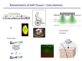 Biomechanics of Soft Tissues – Cees Oomens
Trans-epidermal
drug delivery
Pressure Ulcers
 