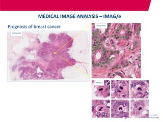 Prognosis of breast cancer
MEDICAL IMAGE ANALYSIS – IMAG/e
HISTOLOGY
NUCLEI SIZE
MITOSES
 