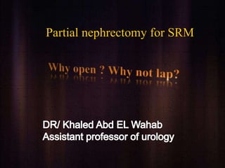 Partial nephrectomy for SRM
 