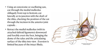 Foot Incision Approaches to foot and ankle Presentation.pdf