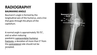 RADIOGRAPHY
Baumann’s angle is formed by the
longitudinal axis of the humerus, and a line
that goes through the physis of the
capitellum.
A normal angle is approximately 70-75°,
and so when reducing
paediatric supracondylar humerus
fractures, a devia)on of more than 5° from
the contralateral side should not be
accepted.
•
BAUMANNS ANGLE
 