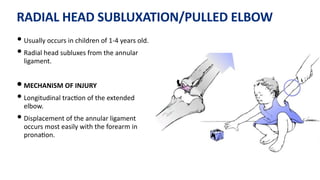 RADIAL HEAD SUBLUXATION/PULLED ELBOW
• Usually occurs in children of 1-4 years old.
• Radial head subluxes from the annular
ligament.
• MECHANISM OF INJURY
• Longitudinal trac)on of the extended
elbow.
• Displacement of the annular ligament
occurs most easily with the forearm in
prona)on.
 