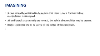 IMAGINING
• X-rays should be obtained to be certain that there is not a fracture before
manipulation is attempted.
• AP and lateral x-rays usually are normal, but subtle abnormalities may be present.
• Radio - capitellar line to be lateral to the center of the capitellum.
•
 