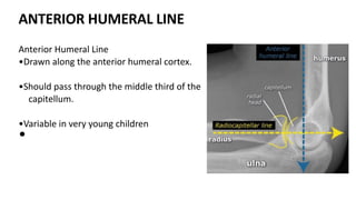 ANTERIOR HUMERAL LINE
Anterior Humeral Line
•Drawn along the anterior humeral cortex.
•Should pass through the middle third of the
capitellum.
•Variable in very young children
•
 