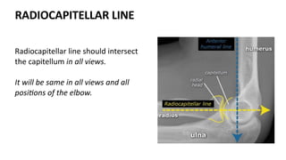 RADIOCAPITELLAR LINE
Radiocapitellar line should intersect
the capitellum in all views.
It will be same in all views and all
posi2ons of the elbow.
 