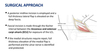 SURGICAL APPROACH
• A posterior midline incision is employed and a
full thickness lateral ﬂap is elevated on the
deep fascia.
• Fascial incision is made through the Kocher
interval between the Anconeus and extensor
carpi ulnaris (ECU) for exposure of the LCL.
• If the medial structures require repair, full
thickness eleva)on of the medial ﬂap is
performed and the ulnar nerve is iden)ﬁed
and protected.
 