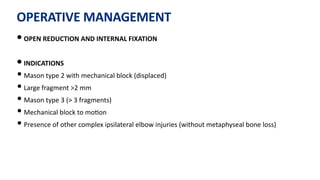 OPERATIVE MANAGEMENT
• OPEN REDUCTION AND INTERNAL FIXATION
• INDICATIONS
• Mason type 2 with mechanical block (displaced)
• Large fragment >2 mm
• Mason type 3 (> 3 fragments)
• Mechanical block to mo)on
• Presence of other complex ipsilateral elbow injuries (without metaphyseal bone loss)
 