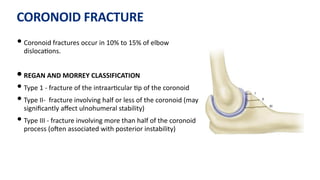 CORONOID FRACTURE
• Coronoid fractures occur in 10% to 15% of elbow
disloca)ons.
• REGAN AND MORREY CLASSIFICATION
• Type 1 - fracture of the intraar)cular )p of the coronoid
• Type II- fracture involving half or less of the coronoid (may
signiﬁcantly aﬀect ulnohumeral stability)
• Type III - fracture involving more than half of the coronoid
process (oJen associated with posterior instability)
 