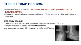 TERRIBLE TRIAD OF ELBOW
Terrible triad injuries consist of a FRACTURE OF THE RADIAL HEAD ,CORONOID AND AN
ELBOW DISLOCATION.
•They occur by posterolateral rotatory displacement of ulna resul)ng in elbow sub luxa)on or
disloca)on
MECHANISM OF INJURY
• Fall on outstretched arm with supina)on, valgus and axial direc)on force.
• The trochlea causes a shear fracture of the coronoid
and is accompanied by an LCL injury and / or radial head fracture
 