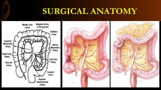 SURGICAL ANATOMY
 