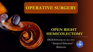 OPEN RIGHT
HEMICOLECTOMY
DR.B.Selvaraj MS; Mch; FICS;
“ Surgical Educator”
Malaysia
OPERATIVE SURGERY
 