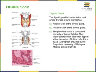 FIGURE 17.12 
Thyroid Gland 
The thyroid gland is located in the neck 
where it wraps around the trachea. 
(a) Anterior view of the thyroid gland. 
(b) Posterior view of the thyroid gland. 
(c) The glandular tissue is composed 
primarily of thyroid follicles. The 
larger parafollicular cells often appear 
within the matrix of follicle cells. LM × 
1332. (Micrograph provided by the 
Regents of University of Michigan 
Medical School © 2012) 
 