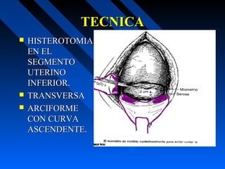 TECNICATECNICA
 HISTEROTOMIAHISTEROTOMIA
EN ELEN EL
SEGMENTOSEGMENTO
UTERINOUTERINO
INFERIOR.INFERIOR.
 TRANSVERSATRANSVERSA
 ARCIFORMEARCIFORME
CON CURVACON CURVA
ASCENDENTE.ASCENDENTE.
 