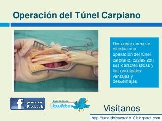 Operación del Túnel Carpiano
Descubre como se
efectúa una
operación del túnel
carpiano, cuales son
sus características y
las principales
ventajas y
desventajas
http://tuneldelcarpode10.blogspot.com
Visítanos
 
