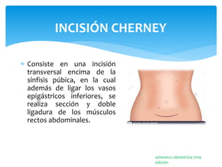 GENERALIDADES SOBRE LA CESAREA, RESIDENCIA DE GINECOLOGIA Y OBSTETRICIA ...