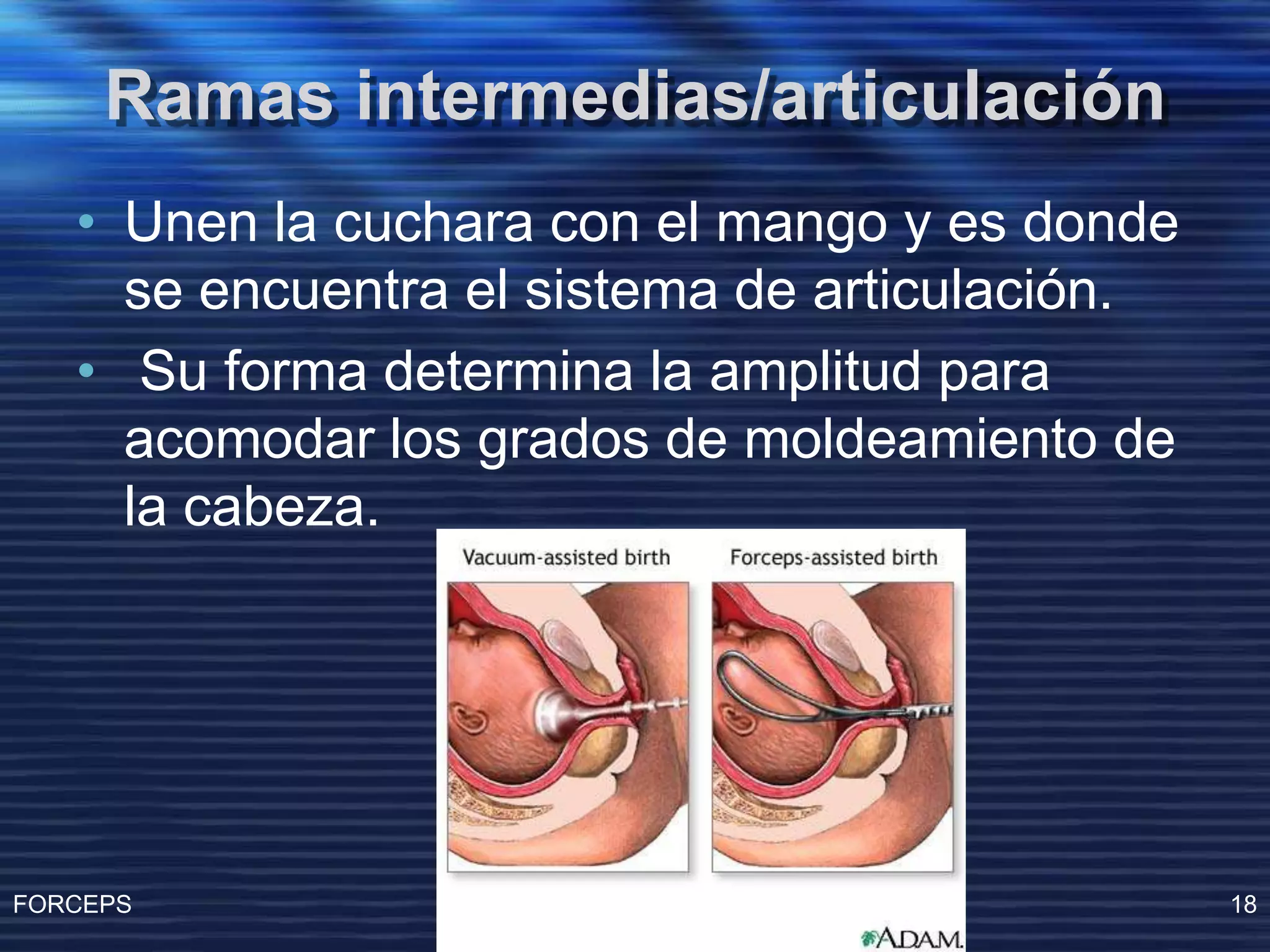 Operacion Con Forceps