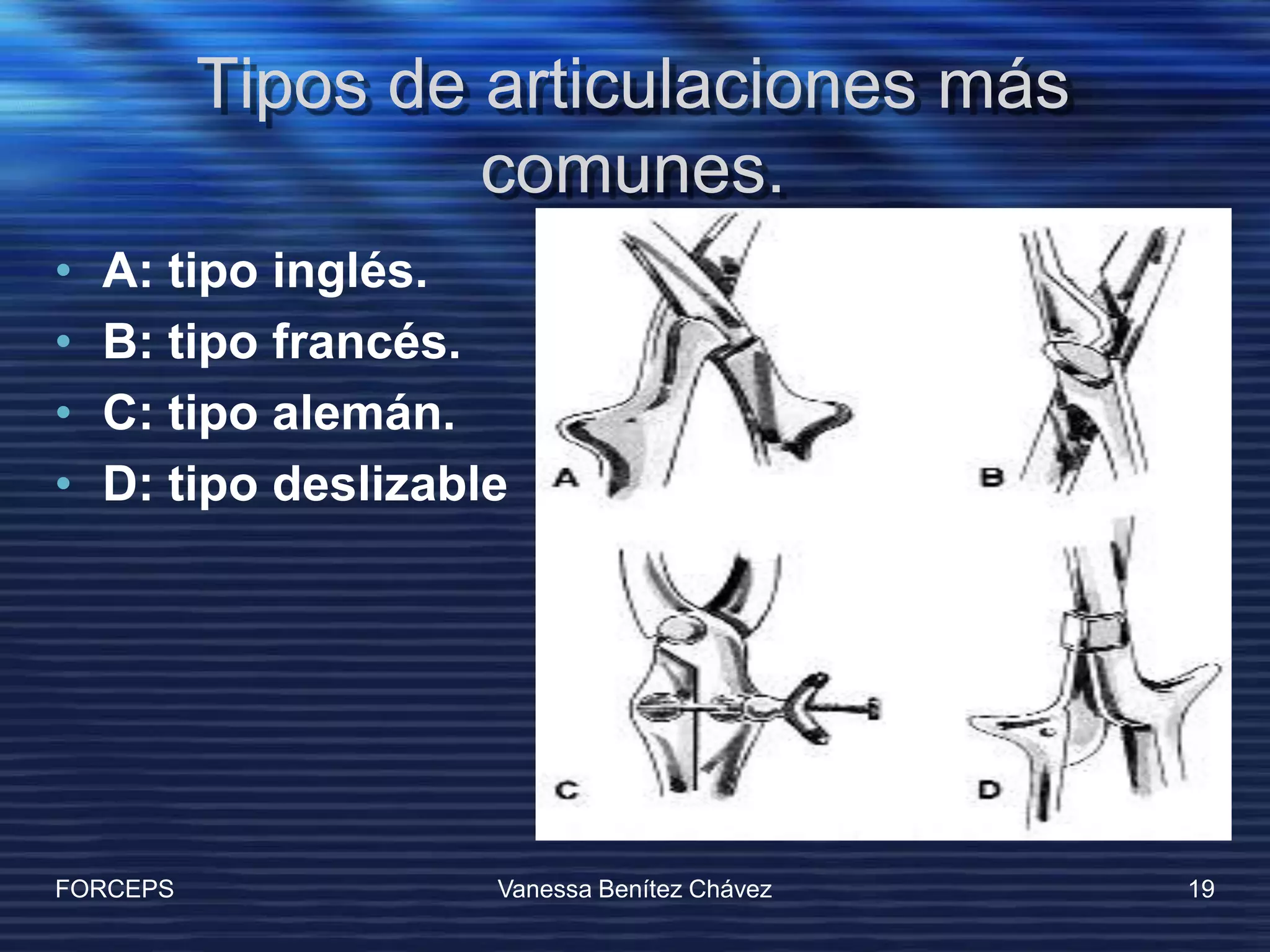 Operacion Con Forceps