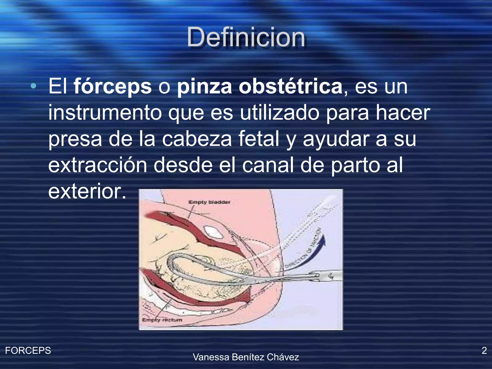 Operacion Con Forceps