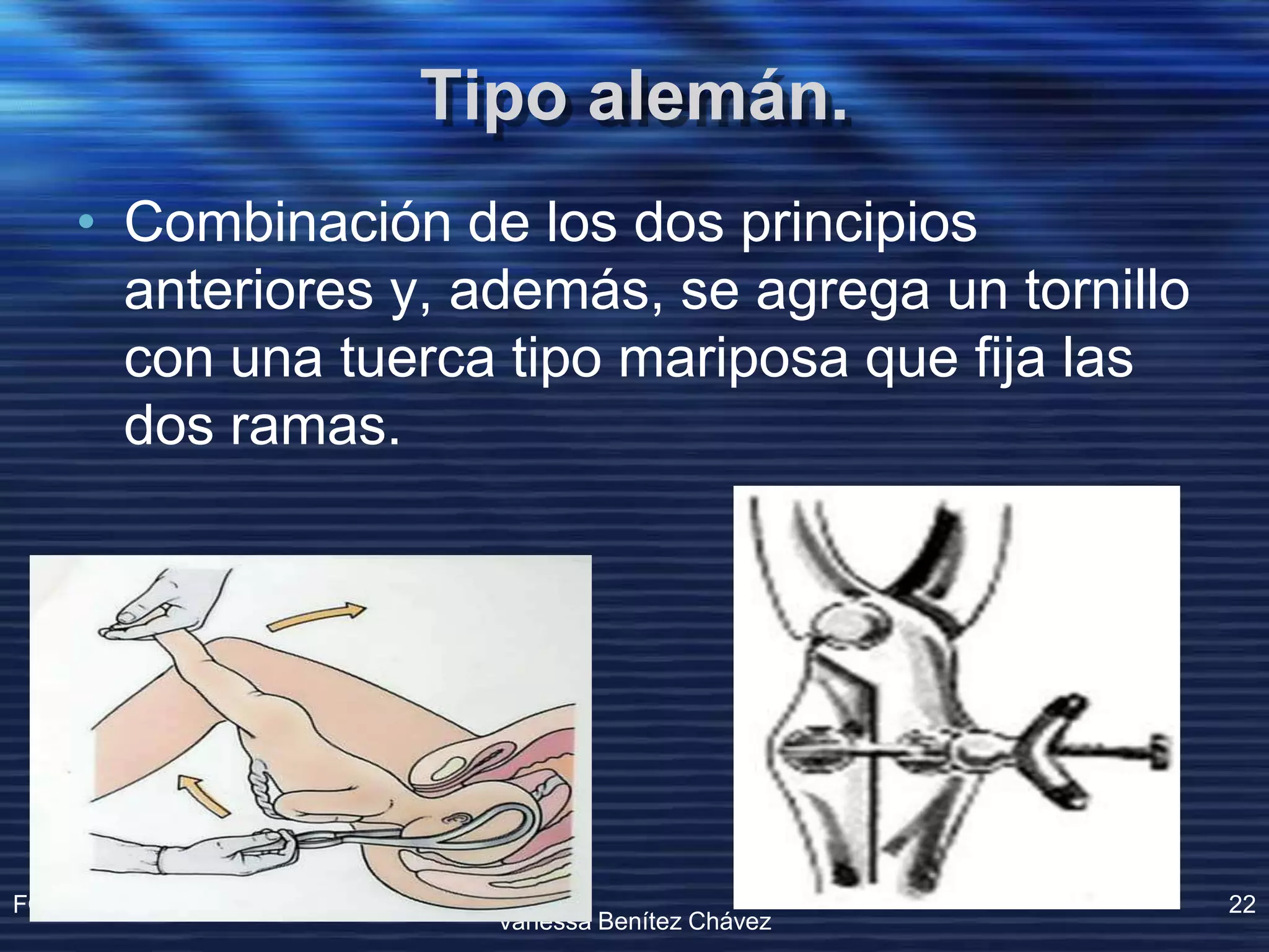 Operacion Con Forceps