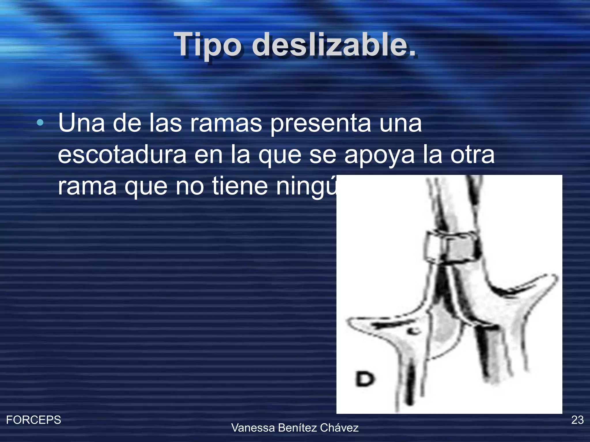 Operacion Con Forceps