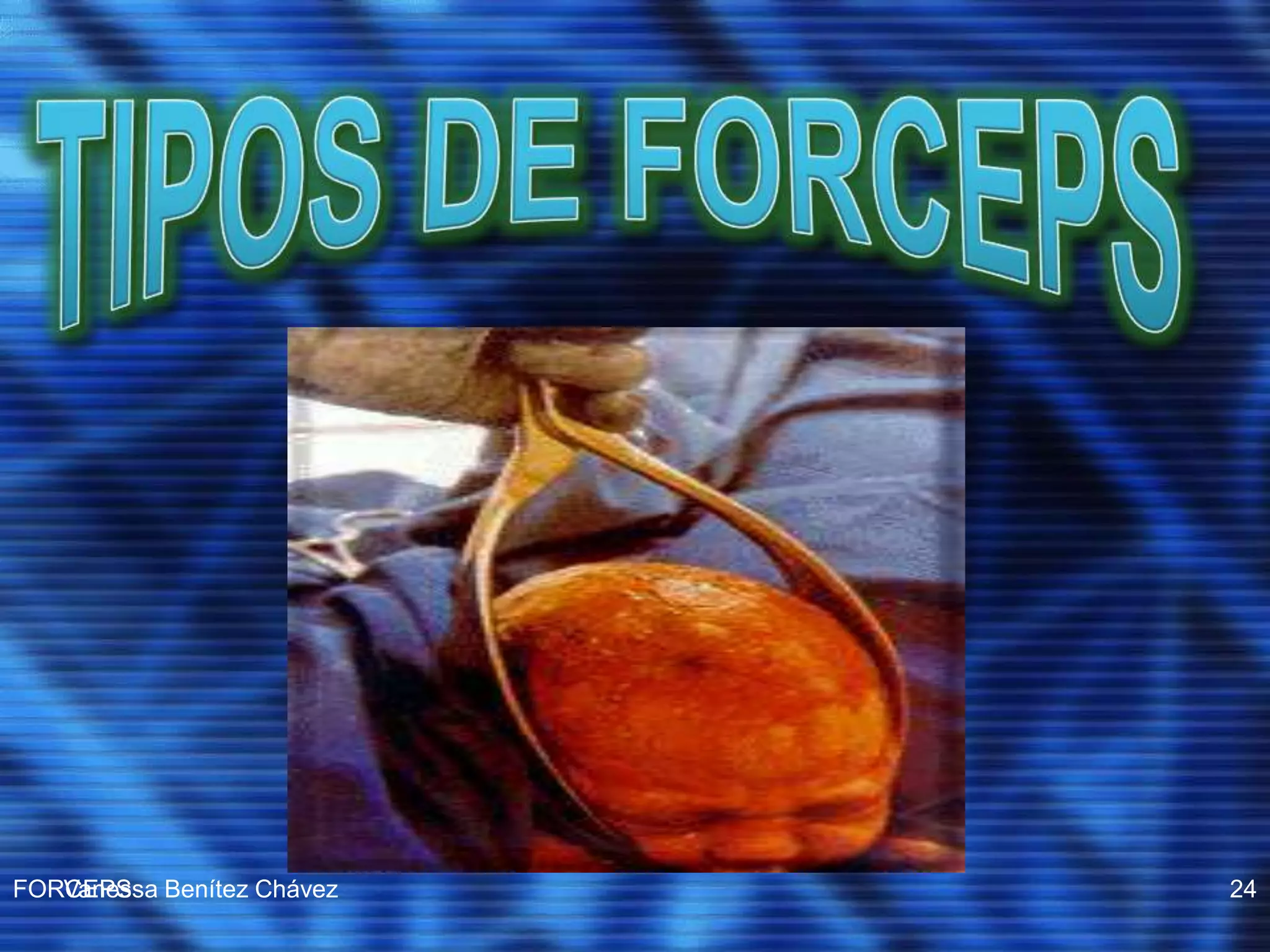 Operacion Con Forceps