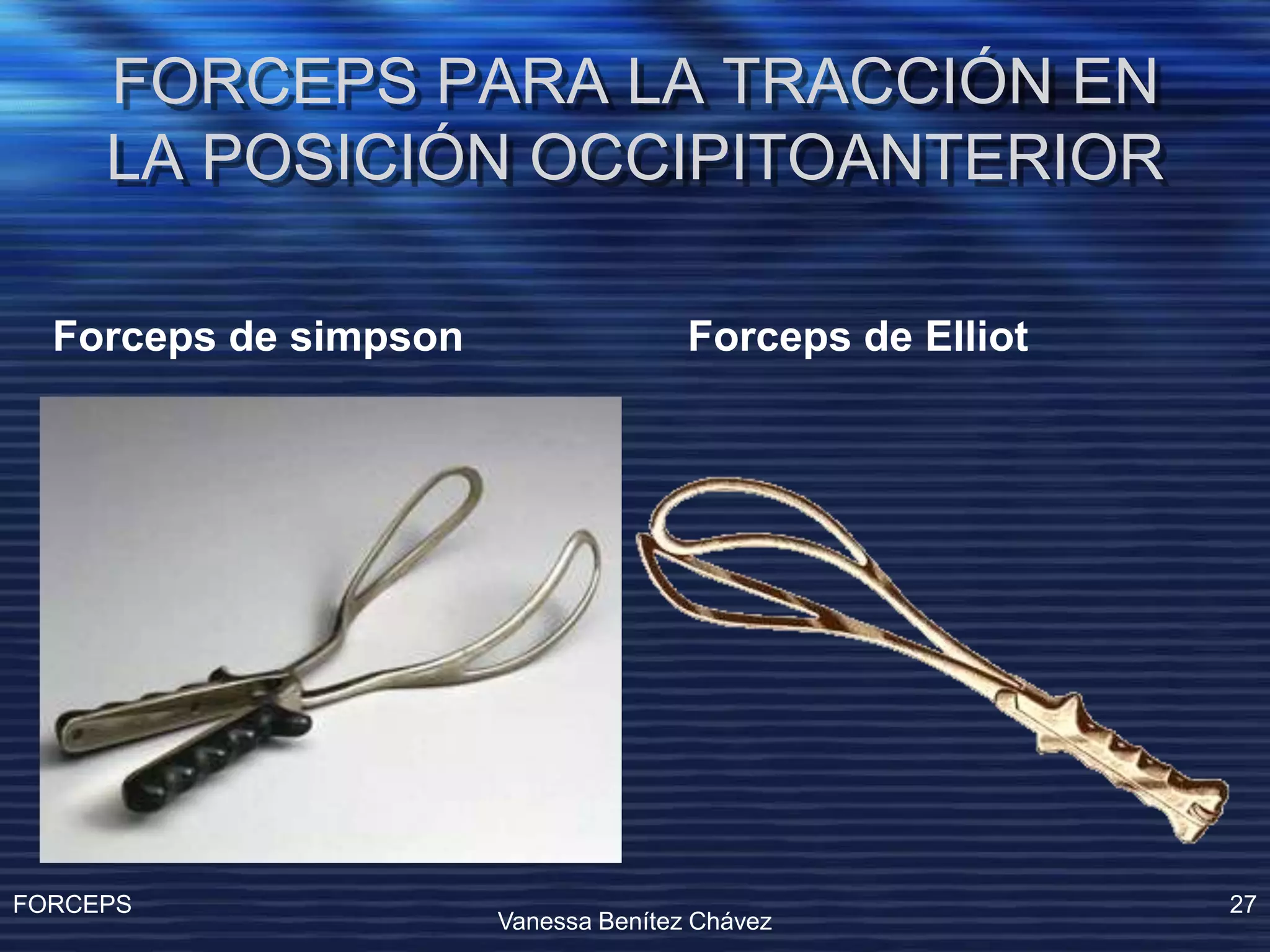 Operacion Con Forceps