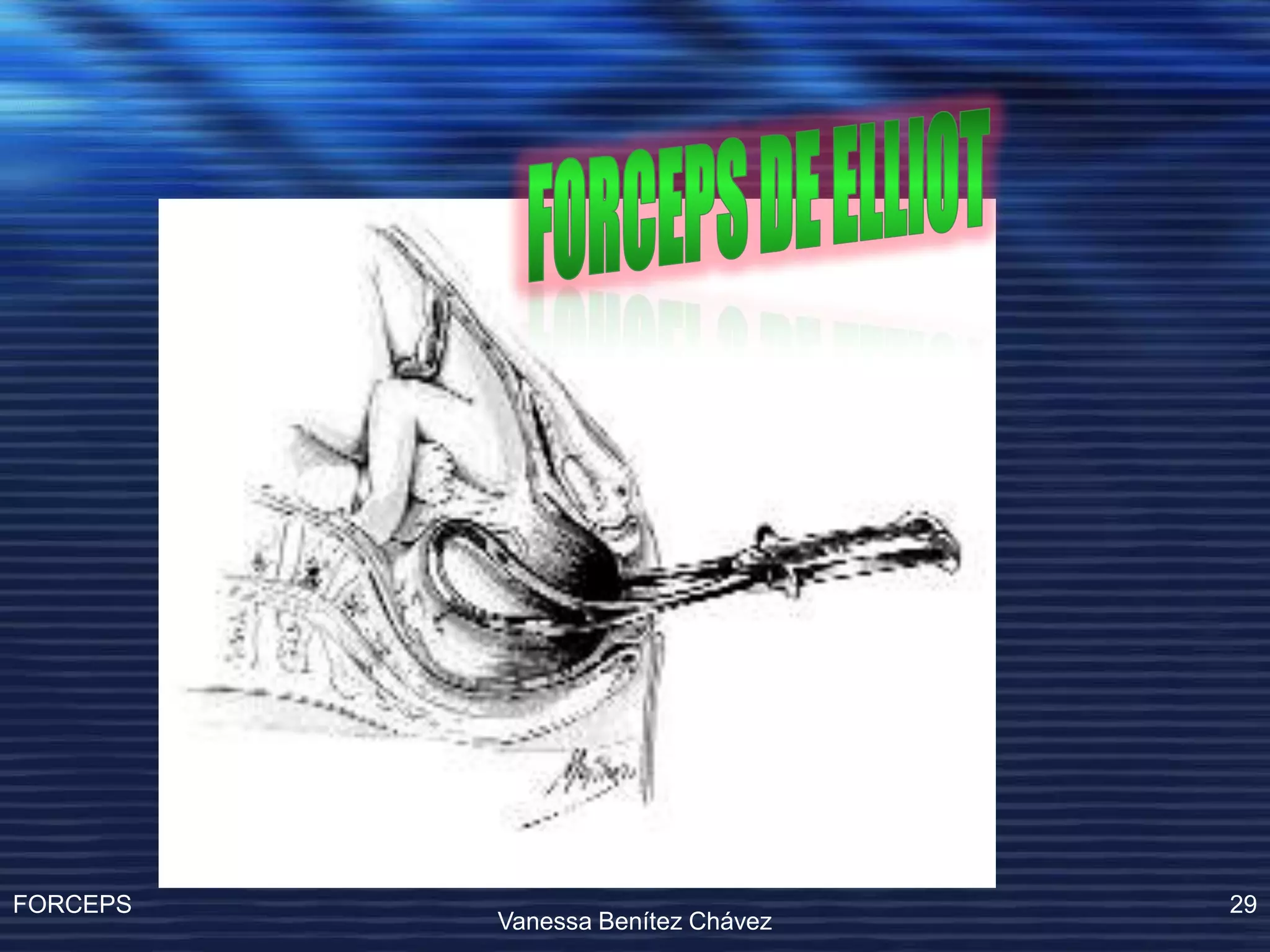 Operacion Con Forceps