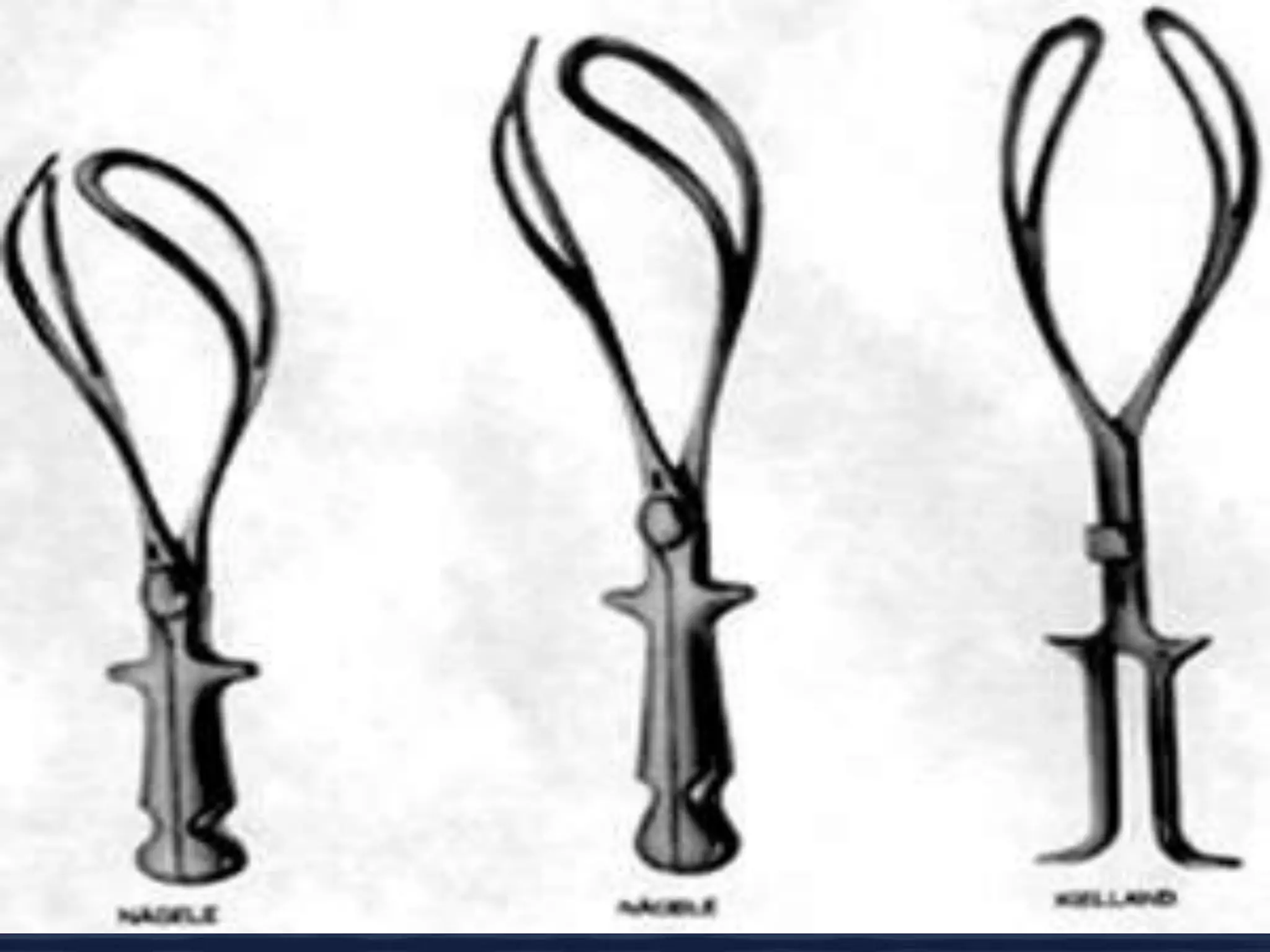 Operacion Con Forceps