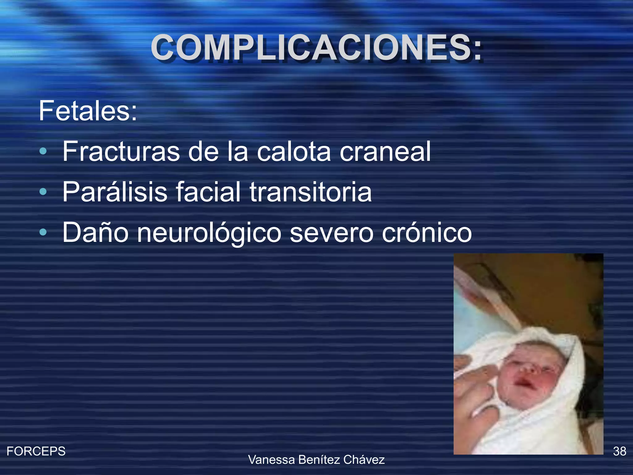 Operacion Con Forceps