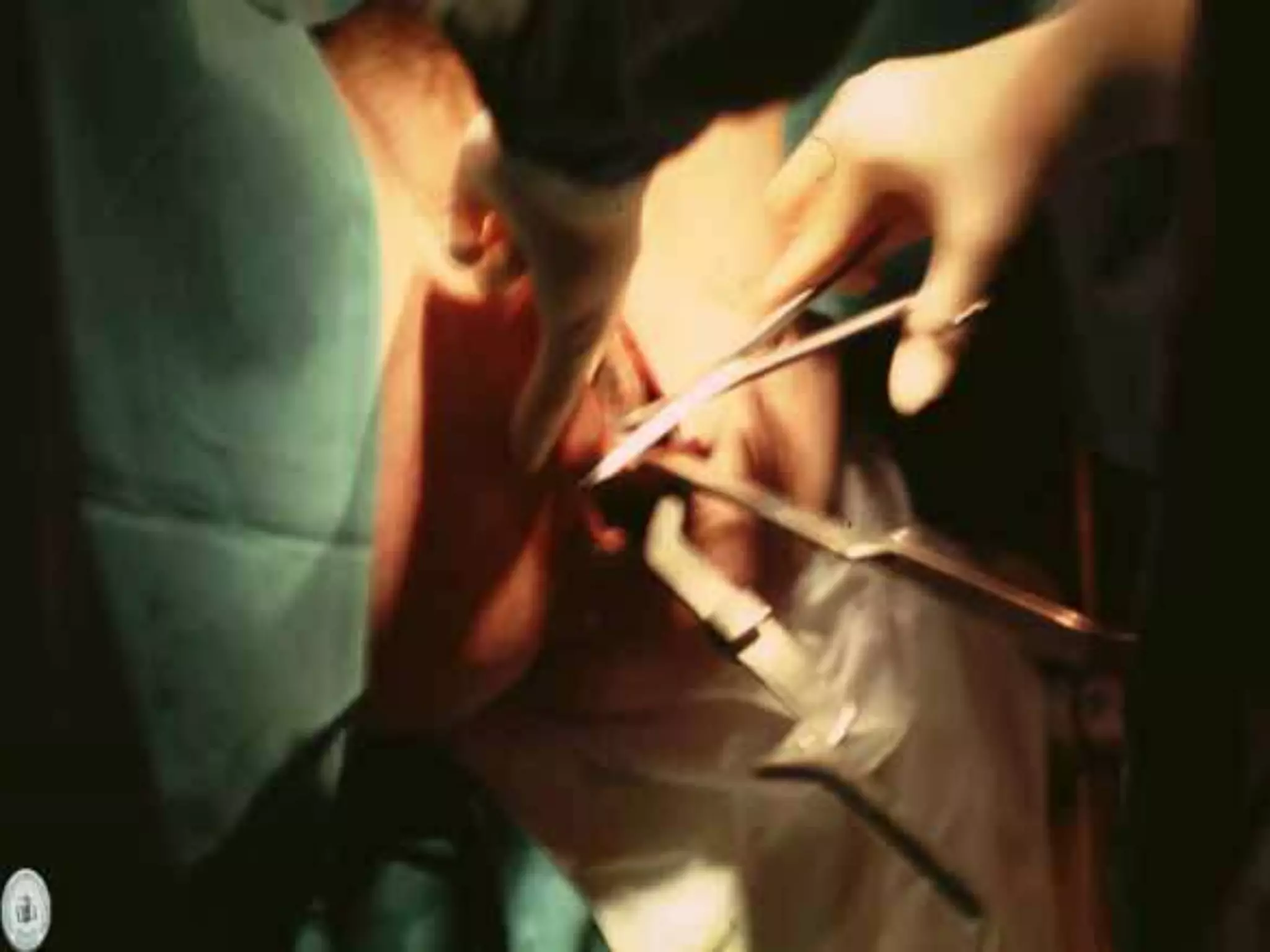 Operacion Con Forceps