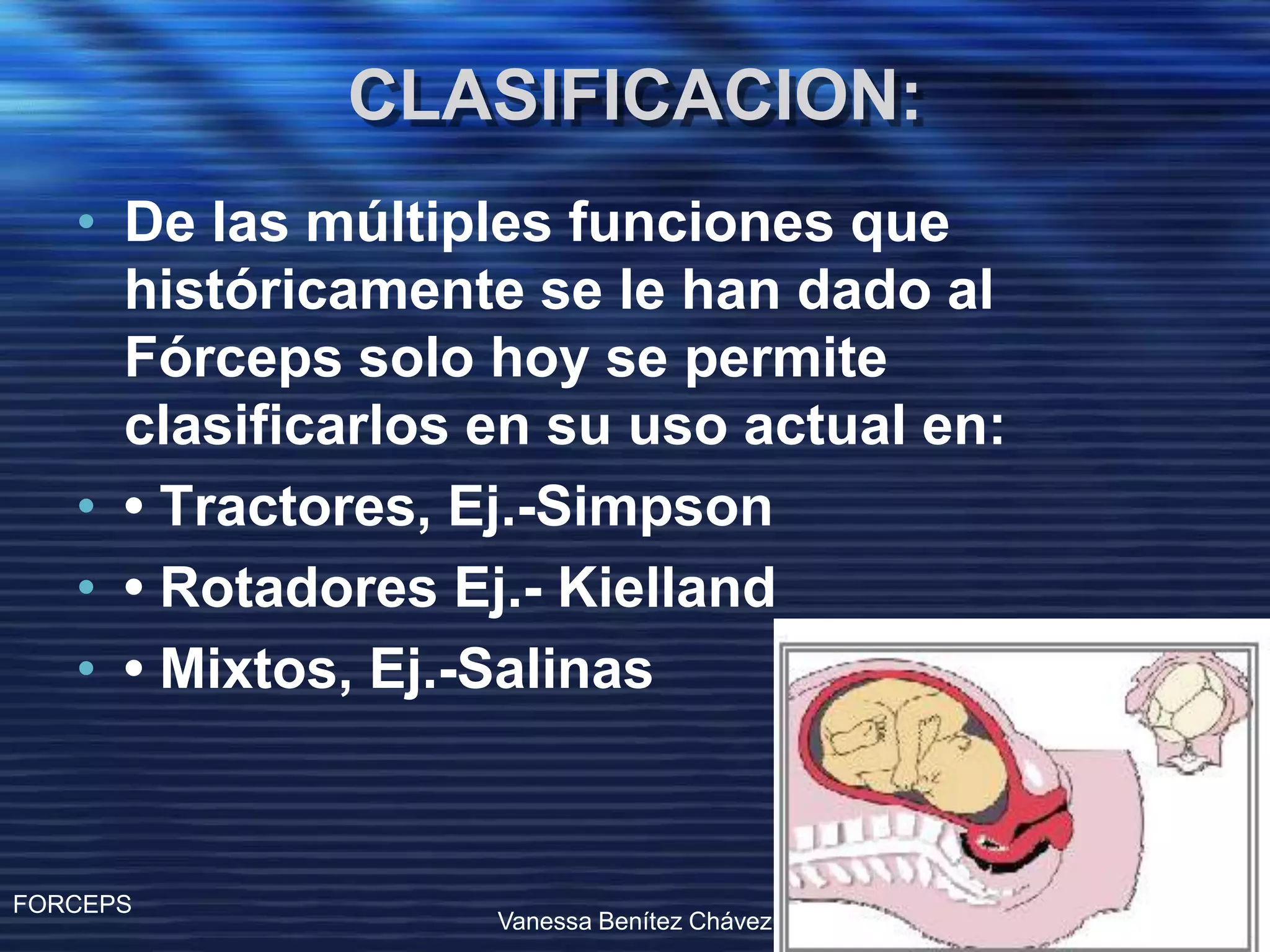 Operacion Con Forceps