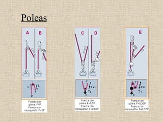 Poleas 
