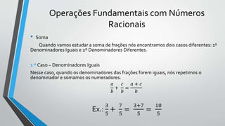 Operações Fundamentais com Números
Racionais
• Soma
Quando vamos estudar a soma de frações nós encontramos dois casos diferentes: 1º
Denominadores Iguais e 2º Denominadores Diferentes.
1 º Caso – Denominadores Iguais
Nesse caso, quando os denominadores das frações forem iguais, nós repetimos o
denominador e somamos os numeradores.
𝑎
𝑏
+
𝑐
𝑏
=
𝑎 + 𝑐
𝑏
Ex.:
3
5
+
7
5
=
3+7
5
=
10
5
 