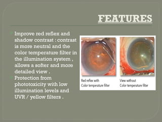 FEATURES
 Improve red reflex and
shadow contrast : contrast
is more neutral and the
color temperature filter in
the illumination system ,
allows a softer and more
detailed view .
 Protection from
phototoxicity with low
illumination levels and
UVR / yellow filters .
 
