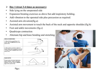 Operation on the pleura