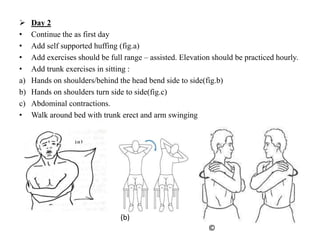 Operation on the pleura