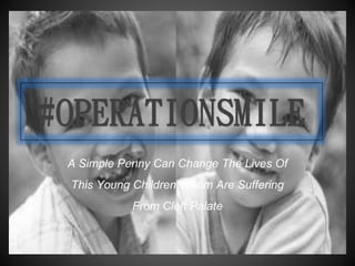 #OPERATIONSMILE
A Simple Penny Can Change The Lives Of
This Young Children Whom Are Suffering
From Cleft Palate
 