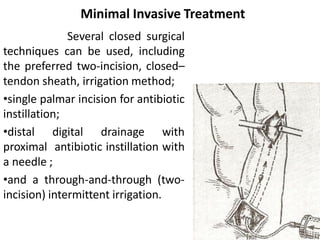 Sheathing Injuries Surgical Techniques and Anatomy of Muscles and Tendons in the Hand and ...