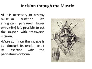 Surgical Techniques and Anatomy of Muscles and Tendons in the Hand and ...