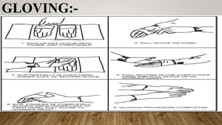 GLOVING:-
 
